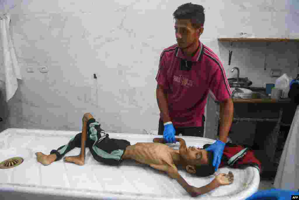 Cadavrul lui Abdul Jawad al-Ghalban, în vârstă de 14 ani, care a murit de foame la morga spitalului Nasser din Khan Yunis, pe 22 iulie 2025.Se estimează că sute de oameni, printre care și aproximativ 150 de copii, au murit de foame în cei doi ani de conflict.